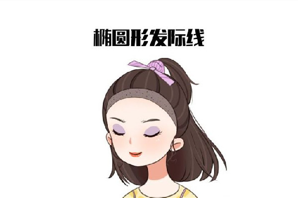 發際線后移怎么恢復 發際線后移是什么原因引起的