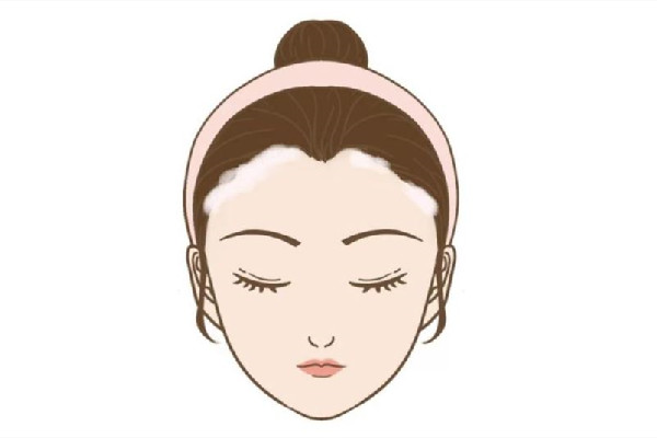 發際線和發量有關系嗎 發際線和經常熬夜有關嗎