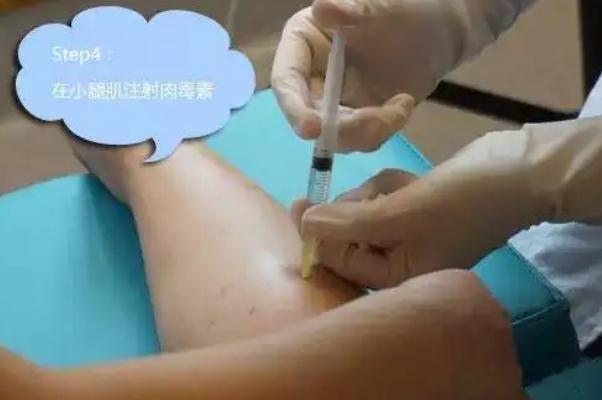 瘦腿針有風險嗎 打瘦腿針有效果嗎
