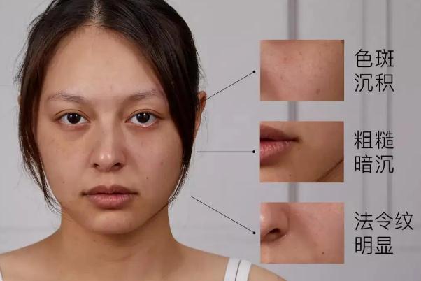 皮膚暗黃有斑怎么調理能變白 皮膚暗黃的主要原因