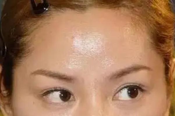 皮膚出油可以直接用散粉嗎 皮膚出油可以吃維生素B6調理嗎