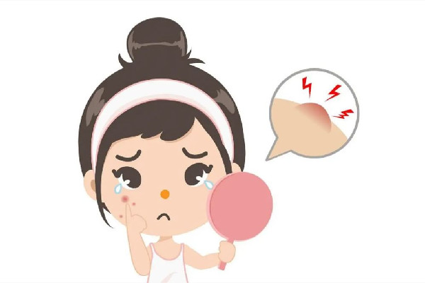 武漢看痘痘去什么醫院最好 武漢看痘痘可以用醫保嗎