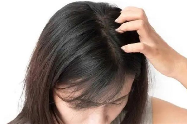 干性頭發怎么護理 干性頭發用有硅油的好一點還是用無硅油好