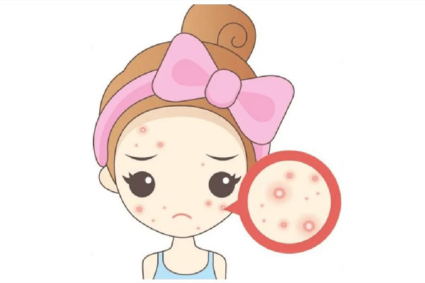 中南路Comely Lady美學中心店痘肌清潔怎么樣 痘肌多久用一次清潔