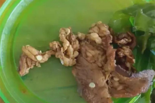 學生質疑店家賣淋巴肉被威脅 淋巴肉吃了會怎樣