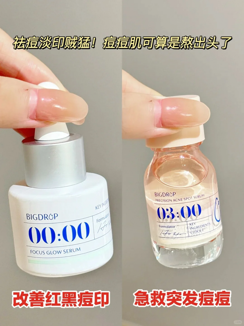 祛痘產(chǎn)品橫測：谷雨白千祛痘凝膠、大水滴與達(dá)爾膚杏仁酸，誰是祛痘王者？