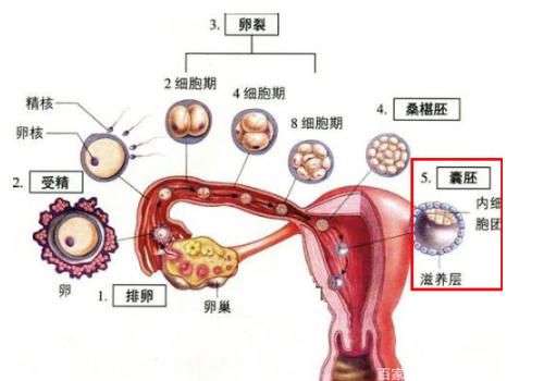 去俄羅斯做試管多少錢？