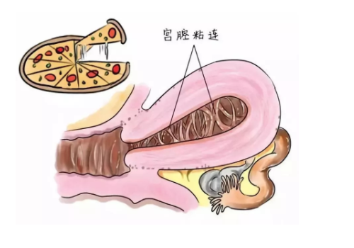 泰國試管嬰兒的詳細流程？