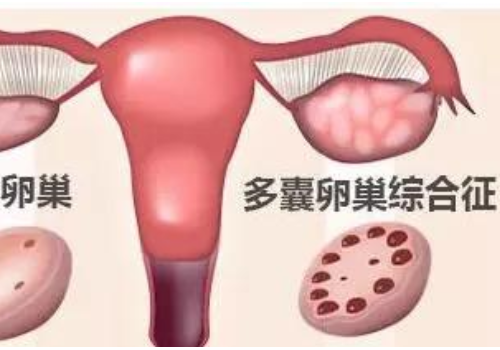 去俄羅斯做試管嬰兒多少錢？